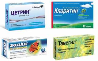 Причины и лечение аллергического конъюнктивита