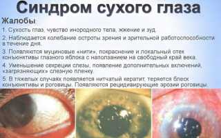 Как проводить лечение глазными каплями Аломид