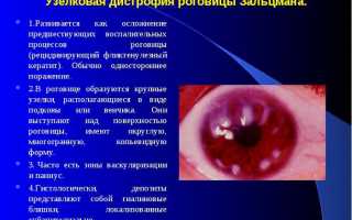 Что вызывает дистрофию роговицы глаза, как проходит лечение