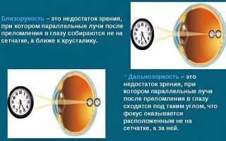 Отзывы офтальмологов об очках для компьютера