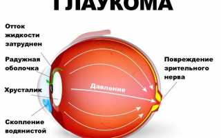 Причины появления кисты на глазу и методы лечения