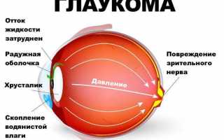 Почему после сна обычно красные глаза