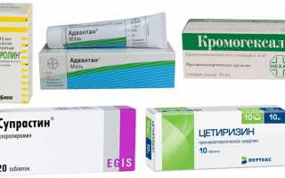 Чем лечить, когда глаза чешутся и опухают при аллергии