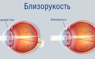 Таблицы для проверки детского зрения