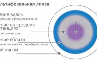 Какими линзами можно пользоваться при близорукости